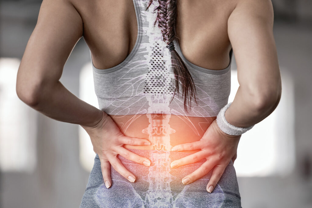 Frau hat Rückenschmerzen